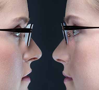 Διαφορα στο πάχος μεταξύ απλών γυαλιών και υψηλού δείκτη διαθλασης